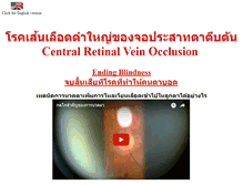 Tablet Screenshot of crvo.doctorsomkiat.com